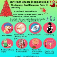 Why Is Hemophilia B Called Christmas Disease